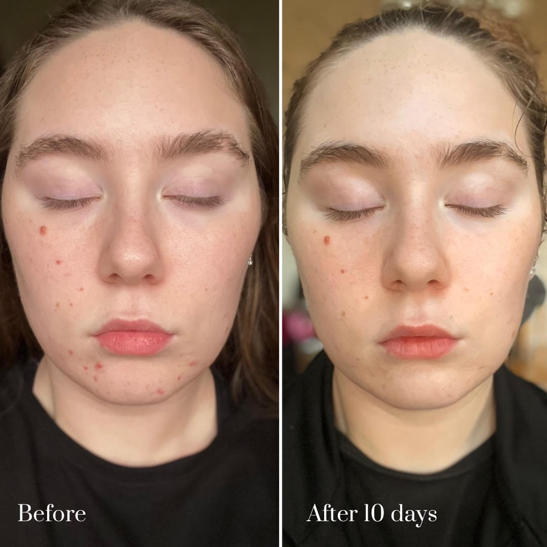 Side by side before and after of Barrier Plus Pigment Potion results